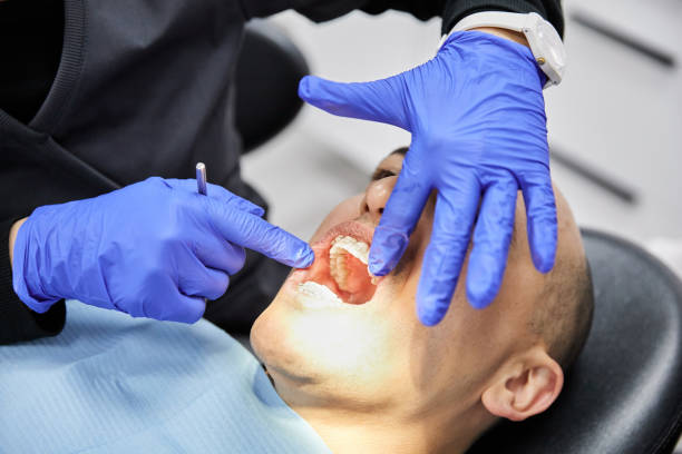 Best Emergency Tooth Extraction in Stockton, MO